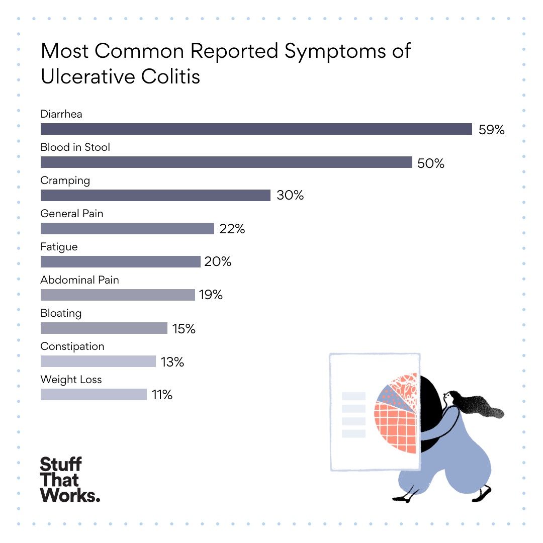 SymptomsUlcerativeColitis